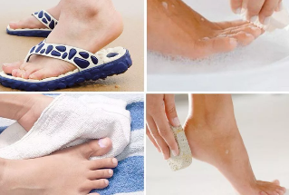 Moossnamen der Verhënnerung vun Pilzerkrankungen